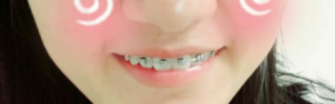 20ݷ