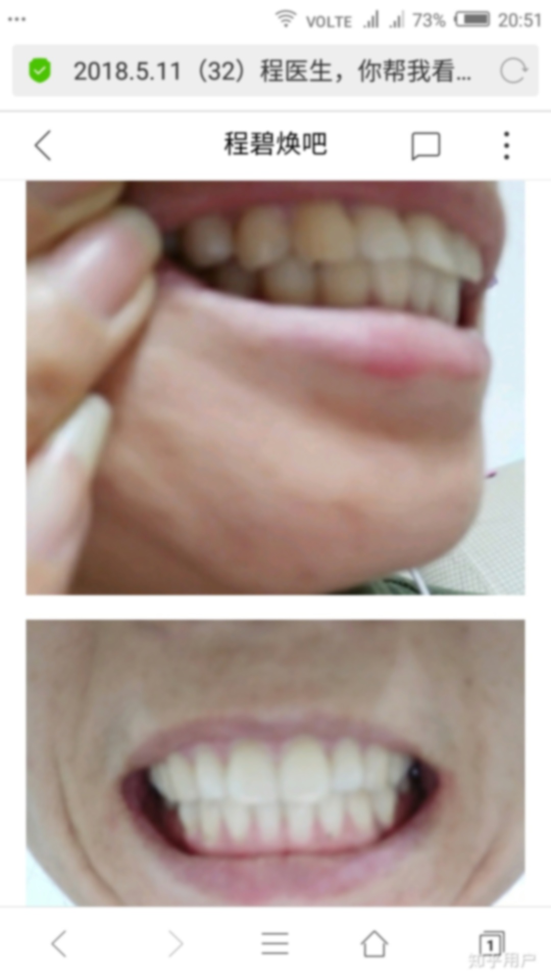 33껹бҪݽ