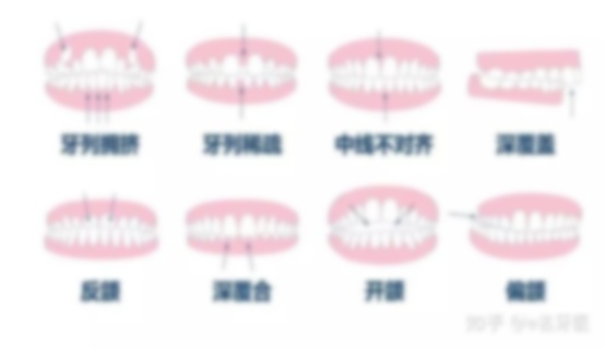 31岁还可以牙齿矫正牙齿吗